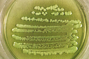 Pseudomonas aeruginosa colonies on agar (by Kenneth Todar PhD)